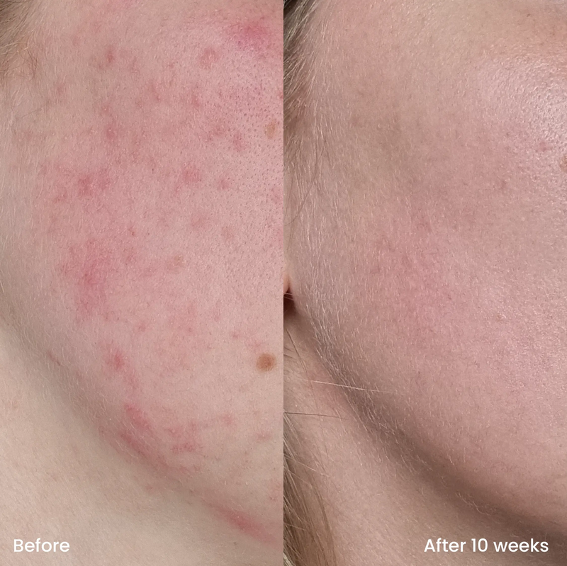 Clay And Glow Vitamine C Serum