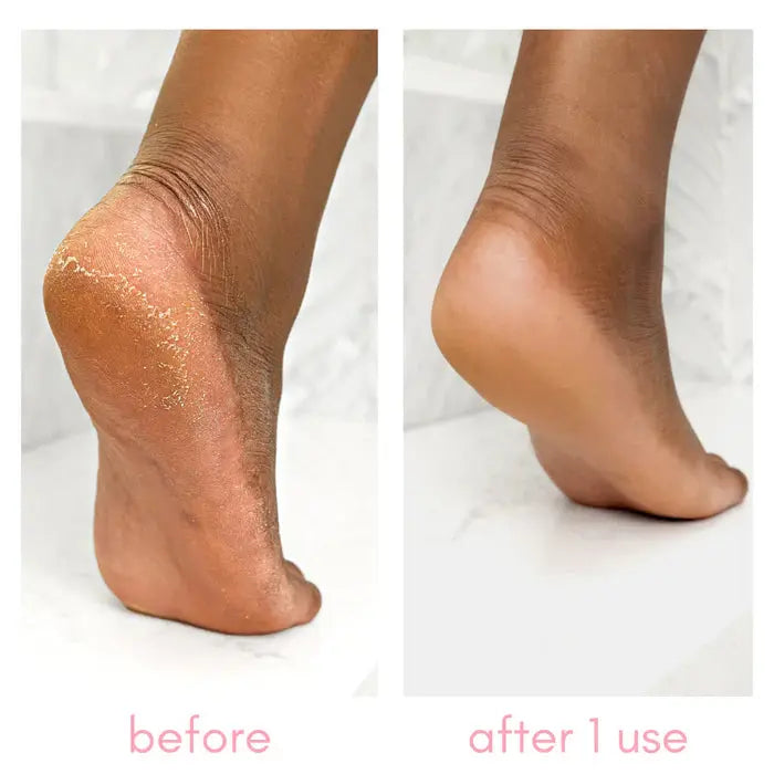 Kiara Sky Heel-ing Callus Remover