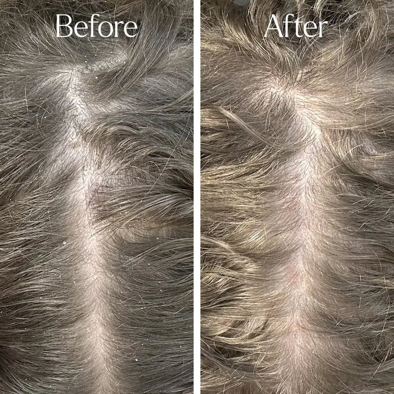 Only Curls Detox Clarifying Shampoo