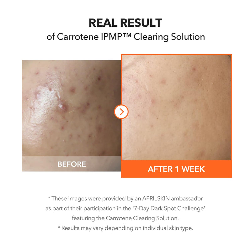 APRILSKIN Carrotene IPMP Clearing Solution