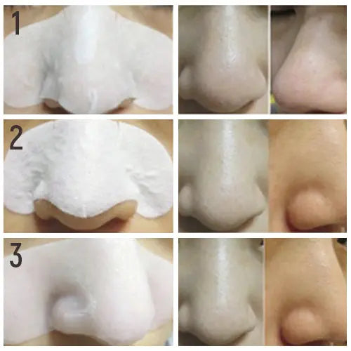 Elizavecca Milky Piggy Black Head 3 Step Solution