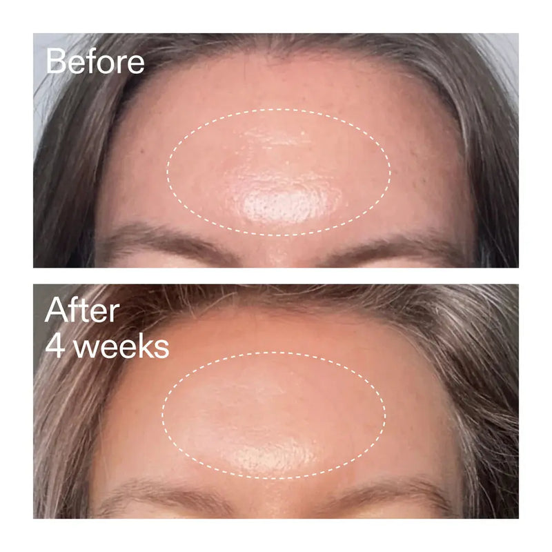 The Inkey List Advanced Retinoid Serum